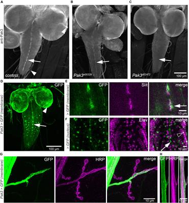 Suppression of spastin Mutant Phenotypes by Pak3 Loss Implicates a Role for Reactive Glia in AD-HSP